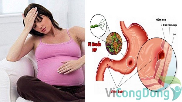 Phòng tránh chứng đau dạ dày khi mang thai